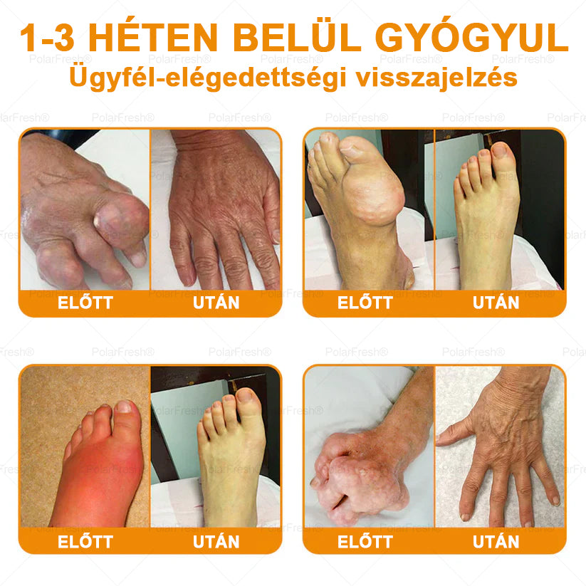 💧🎁 Már csak 5 doboz maradt! További 50%-os kedvezményt kínálunk! Szerezzétek vissza az alakotokat és egészségeteket. Most veszítsetek, és nem lesz több lehetőség jövő évig.