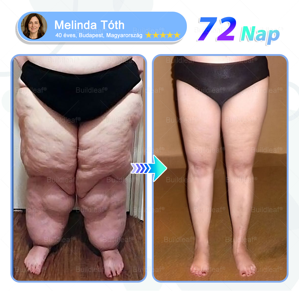 Már csak 5 doboz maradt! A BuildLeaf® 🎁további 50% kedvezményt ad! Állítsd helyre a tested és az egészséged. Használd ki most, később már nem lesz rá lehetőséged.