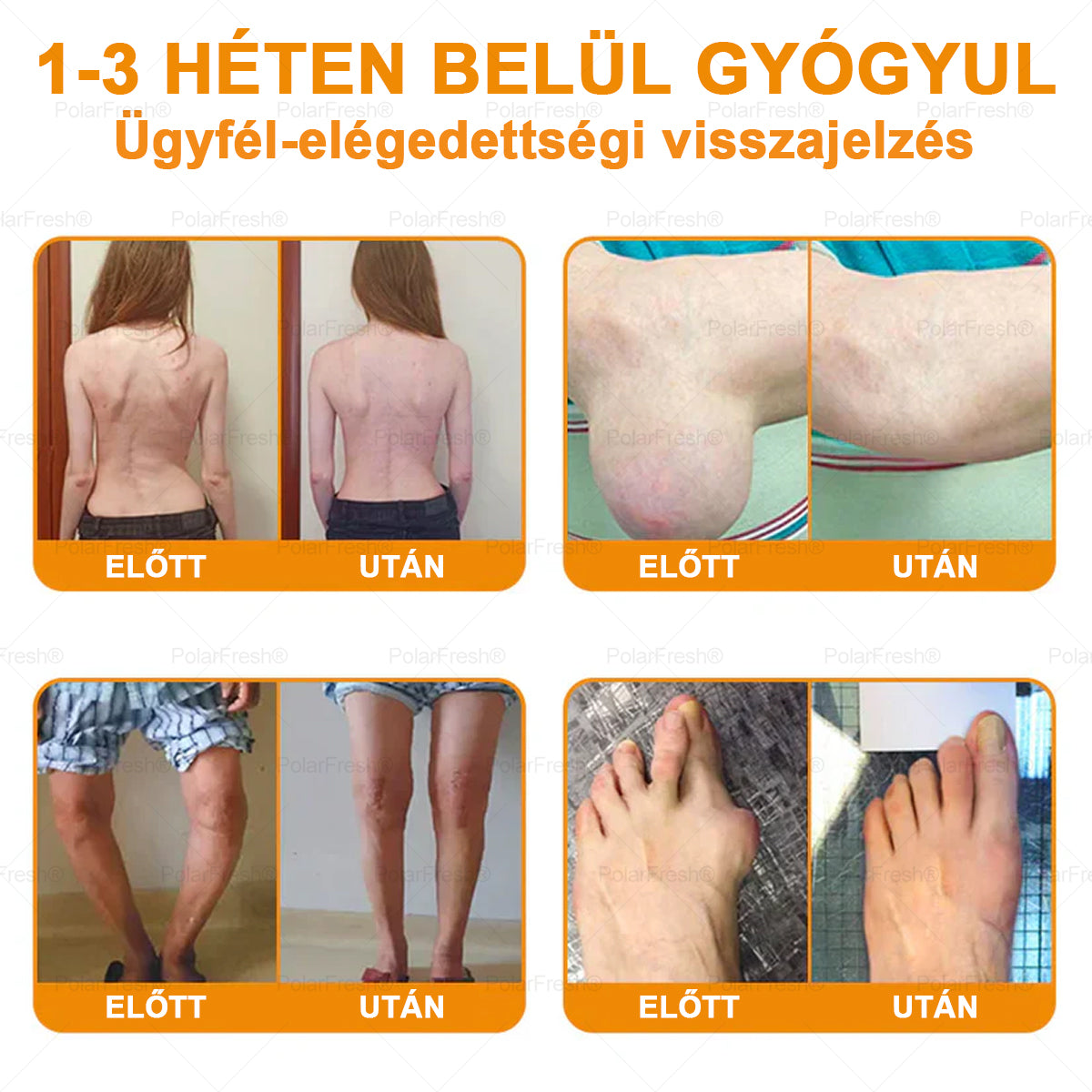 💧🎁 Már csak 5 doboz maradt! További 50%-os kedvezményt kínálunk! Szerezzétek vissza az alakotokat és egészségeteket. Most veszítsetek, és nem lesz több lehetőség jövő évig.