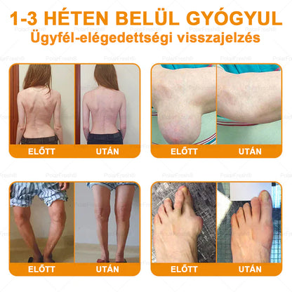 💧🎁 Már csak 5 doboz maradt! További 50%-os kedvezményt kínálunk! Szerezzétek vissza az alakotokat és egészségeteket. Most veszítsetek, és nem lesz több lehetőség jövő évig.