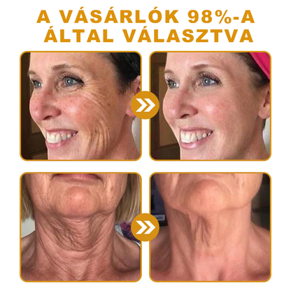 🐝🎁 Már csak 5 doboz maradt! További 50%-os kedvezményt kínálunk! Szerezzétek vissza az alakotokat és egészségeteket. Most veszítsetek, és nem lesz több lehetőség jövő évig.